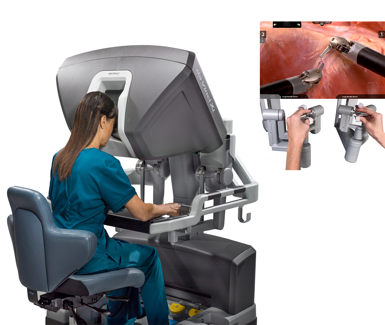 da Vinci Xi Surgical System（手術支援ロボット）