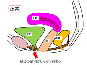 腹圧性尿失禁 - 泌尿器科 - 受診案内 - 聖路加国際病院