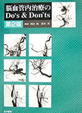 脳血管内治療のDo's＆Don'ts 第２版: 165-192, Endovascular treatment of spinal cord AVMs
